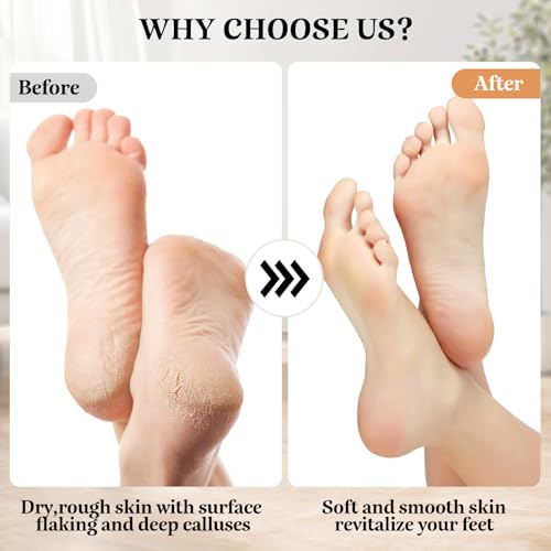 Rechargeable Electric Callus Remover for Feet with 3 Grinding Heads and 2 Speeds for Men and Women
| Foot Scrubber File