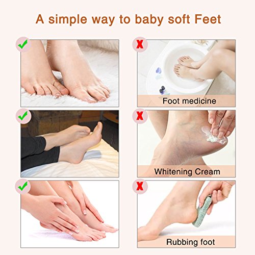 Natural Moisturizing Treatment ALIVER Foot Peel Mask (5 pack) for Repairing Cracked and Rough Heels
| Exfoliate Dead Sk